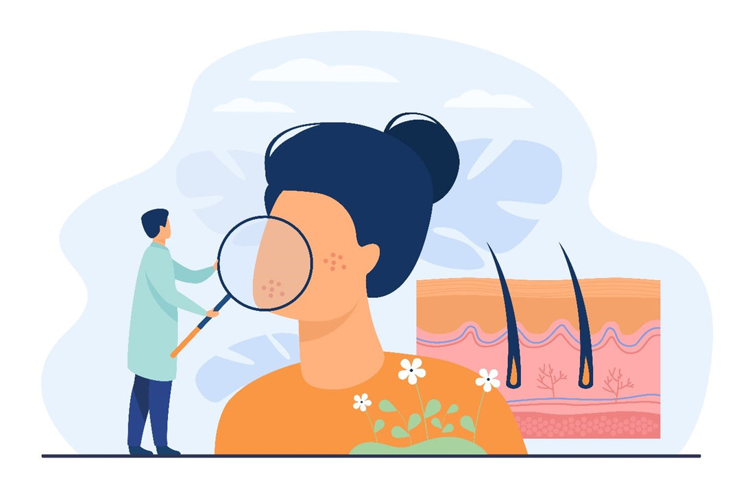 Stuff that you are doing wrong with your dry skin during winters