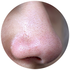 <strong>White & Black Heads</strong>