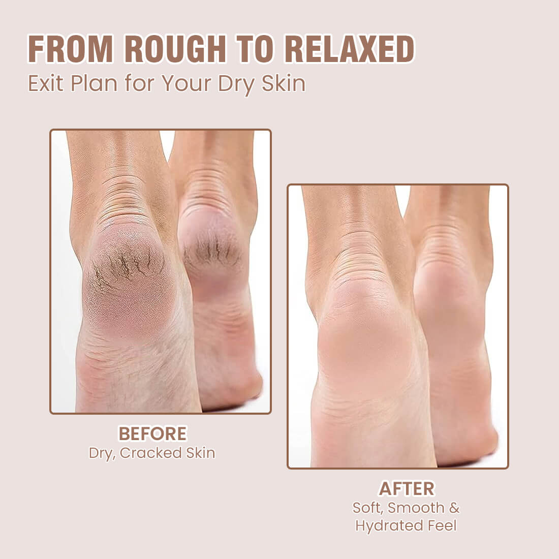 Hand and Foot Cream for Nourished Hand & Feet  ( Non-Sticky and Quick Absorbing )