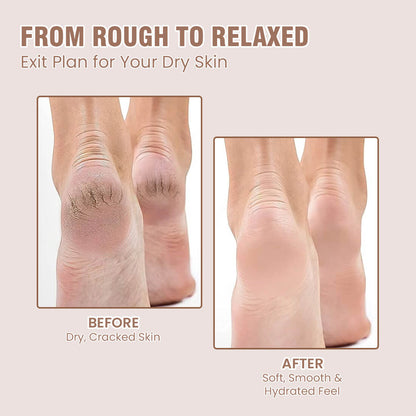 Hand and Foot Cream for Nourished Hand & Feet  ( Non-Sticky and Quick Absorbing )