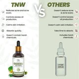 TNW Salicylic Acid Face Serum VS Others